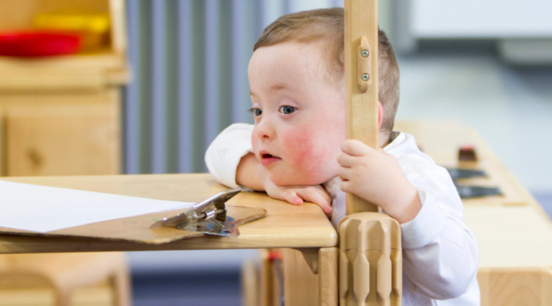 Common Physical Features of Individuals with Down Syndrome